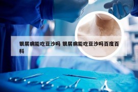 银屑病能吃豆沙吗 银屑病能吃豆沙吗百度百科