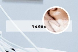 牛皮癣良方