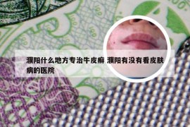 濮阳什么地方专治牛皮癣 濮阳有没有看皮肤病的医院