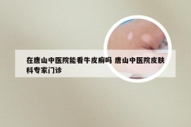 在唐山中医院能看牛皮癣吗 唐山中医院皮肤科专家门诊