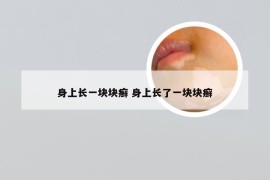身上长一块块癣 身上长了一块块癣