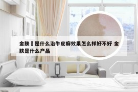金肤楯是什么治牛皮癣效果怎么样好不好 金肤是什么产品