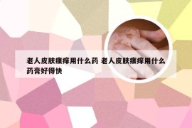 老人皮肤瘙痒用什么药 老人皮肤瘙痒用什么药膏好得快