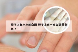 脖子上有小小的白斑 脖子上有一点白斑是怎么了