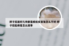 脖子后面好几块都是癣反反复复怎么不好 脖子后起癣是怎么回事