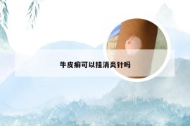 牛皮癣可以挂消炎针吗