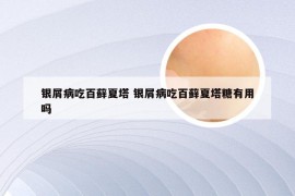 银屑病吃百藓夏塔 银屑病吃百藓夏塔糖有用吗