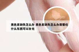 黑色素缺失怎么办 黑色素缺失怎么办需要吃什么东西可以补充