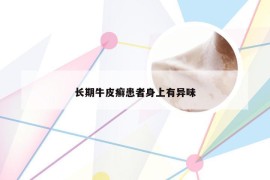 长期牛皮癣患者身上有异味