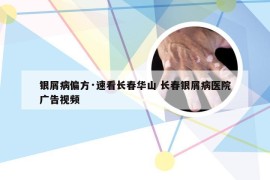 银屑病偏方·速看长春华山 长春银屑病医院广告视频