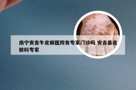 南宁安吉牛皮癣医院有专家门诊吗 安吉县皮肤科专家