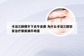 卡泊三醇摸不下去牛皮癣 为什么卡泊三醇软膏治疗银屑病不明显