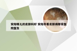 安阳哪儿的皮肤科好 安阳市看皮肤病那家医院医生