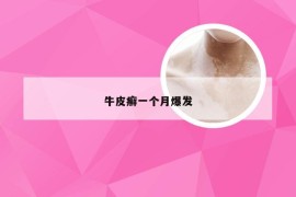 牛皮癣一个月爆发