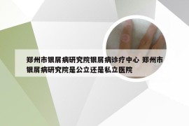 郑州市银屑病研究院银屑病诊疗中心 郑州市银屑病研究院是公立还是私立医院