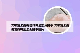 大眼角上面出现白斑是怎么回事 大眼角上面出现白斑是怎么回事图片