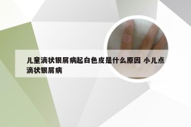 儿童滴状银屑病起白色皮是什么原因 小儿点滴状银屑病