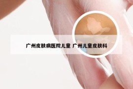 广州皮肤病医院儿童 广州儿童皮肤科