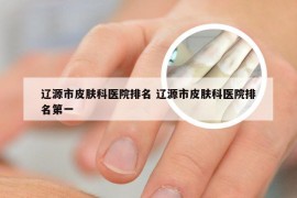 辽源市皮肤科医院排名 辽源市皮肤科医院排名第一