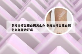 免疫治疗出现白斑怎么办 免疫治疗出现白斑怎么办能治好吗