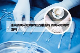 患有白斑可以喝脾肽口服液吗 白斑可以喝啤酒吗