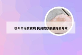 杭州市治皮肤病 杭州皮肤病最好的专家