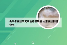 山东省皮肤研究所治疗银屑病 山东皮肤科研究所