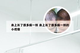 身上长了很多癣一样 身上长了很多癣一样的小疙瘩