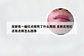 皮肤有一遍红点痒死了什么原因 皮肤出现红点有点痒怎么回事