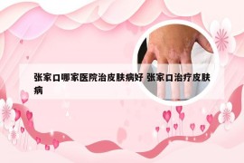 张家口哪家医院治皮肤病好 张家口治疗皮肤病