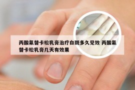 丙酸氟替卡松乳膏治疗白斑多久见效 丙酸氟替卡松乳膏几天有效果