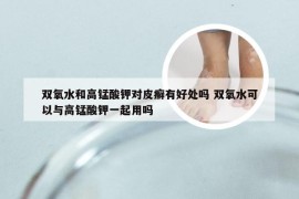 双氧水和高锰酸钾对皮癣有好处吗 双氧水可以与高锰酸钾一起用吗