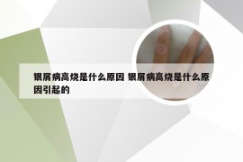 银屑病高烧是什么原因 银屑病高烧是什么原因引起的