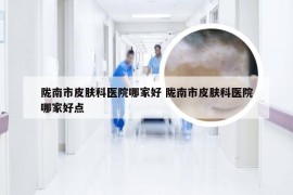 陇南市皮肤科医院哪家好 陇南市皮肤科医院哪家好点