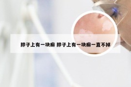 脖子上有一块癣 脖子上有一块癣一直不掉