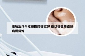 廊坊治疗牛皮癣医院哪家好 廊坊哪里看皮肤病看得好