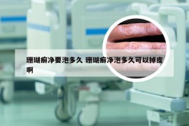 珊瑚癣净要泡多久 珊瑚癣净泡多久可以掉皮啊