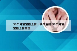 30个月宝宝脸上有一块白色的 30个月宝宝脸上有白斑