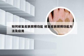 如何修复皮肤屏障功能 修复皮肤屏障功能方法及应用