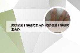皮肤总是干燥起皮怎么办 皮肤老是干燥起皮怎么办
