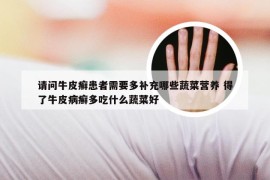 请问牛皮癣患者需要多补充哪些蔬菜营养 得了牛皮病癣多吃什么蔬菜好