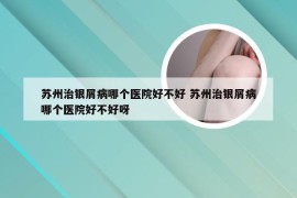 苏州治银屑病哪个医院好不好 苏州治银屑病哪个医院好不好呀