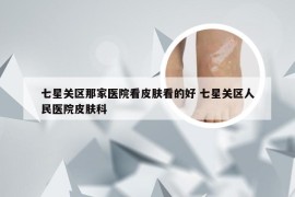 七星关区那家医院看皮肤看的好 七星关区人民医院皮肤科