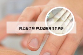 脚上起了癣 脚上起癣用什么药膏