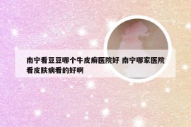 南宁看豆豆哪个牛皮癣医院好 南宁哪家医院看皮肤病看的好啊