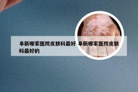 阜新哪家医院皮肤科最好 阜新哪家医院皮肤科最好的