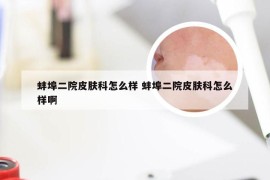 蚌埠二院皮肤科怎么样 蚌埠二院皮肤科怎么样啊