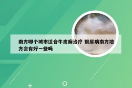 南方哪个城市适合牛皮癣治疗 银屑病南方地方会有好一些吗