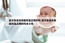 临沂鲁南皮肤医院是正规的吗 临沂鲁南皮肤医院是正规的吗多少钱