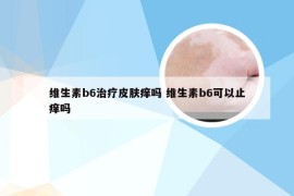 维生素b6治疗皮肤痒吗 维生素b6可以止痒吗